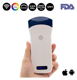 ΣΥΣΚΕΥΕΣ ΥΠΕΡΗΧΩΝ